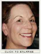 Cosmetic Dentistry - David DiLoreto