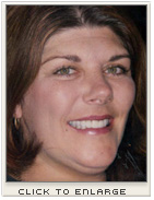 Cosmetic Dentistry - David DiLoreto